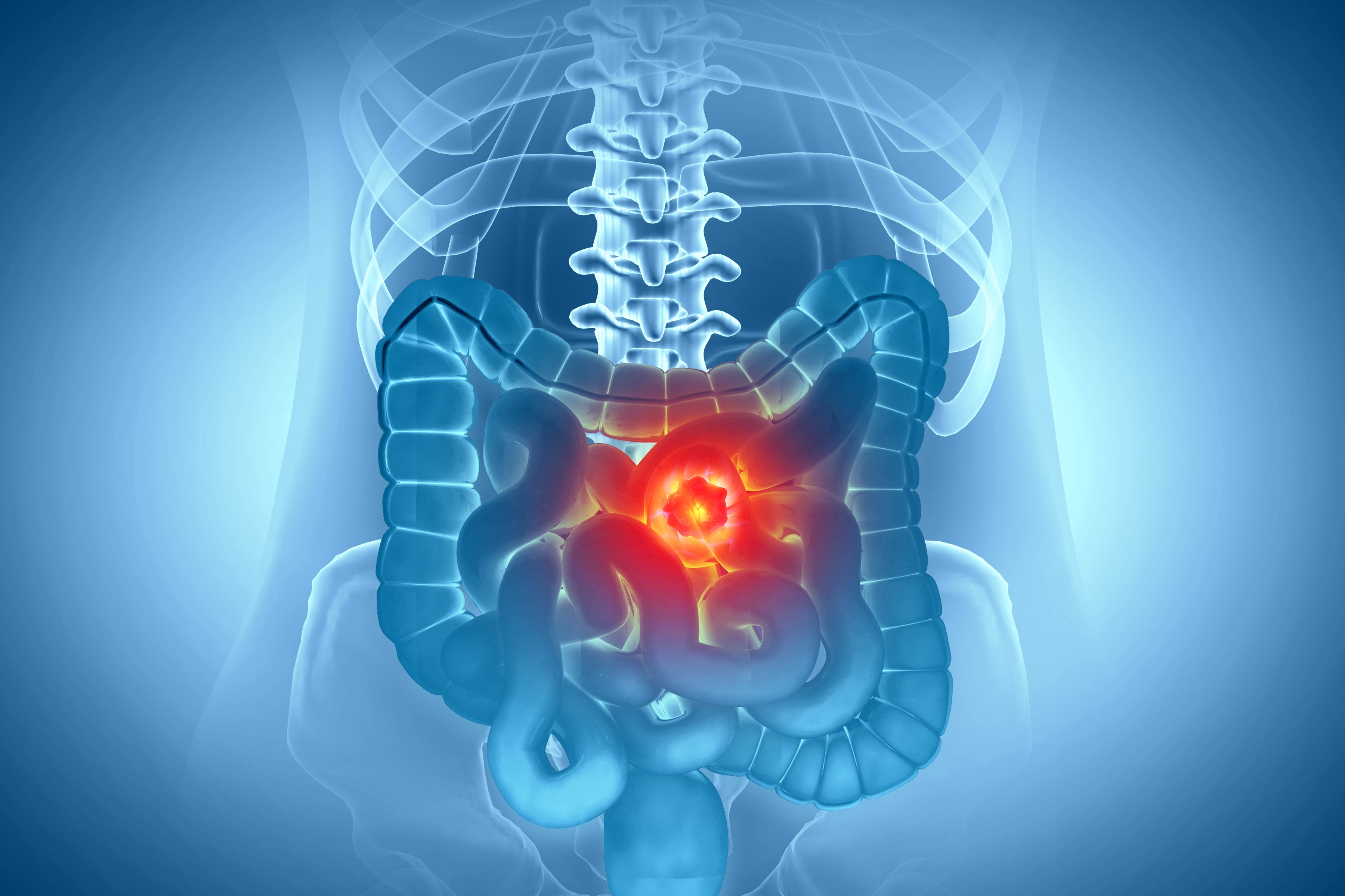 Targeting KRAS G12C: Focus on Lung Cancer and GI Malignancies