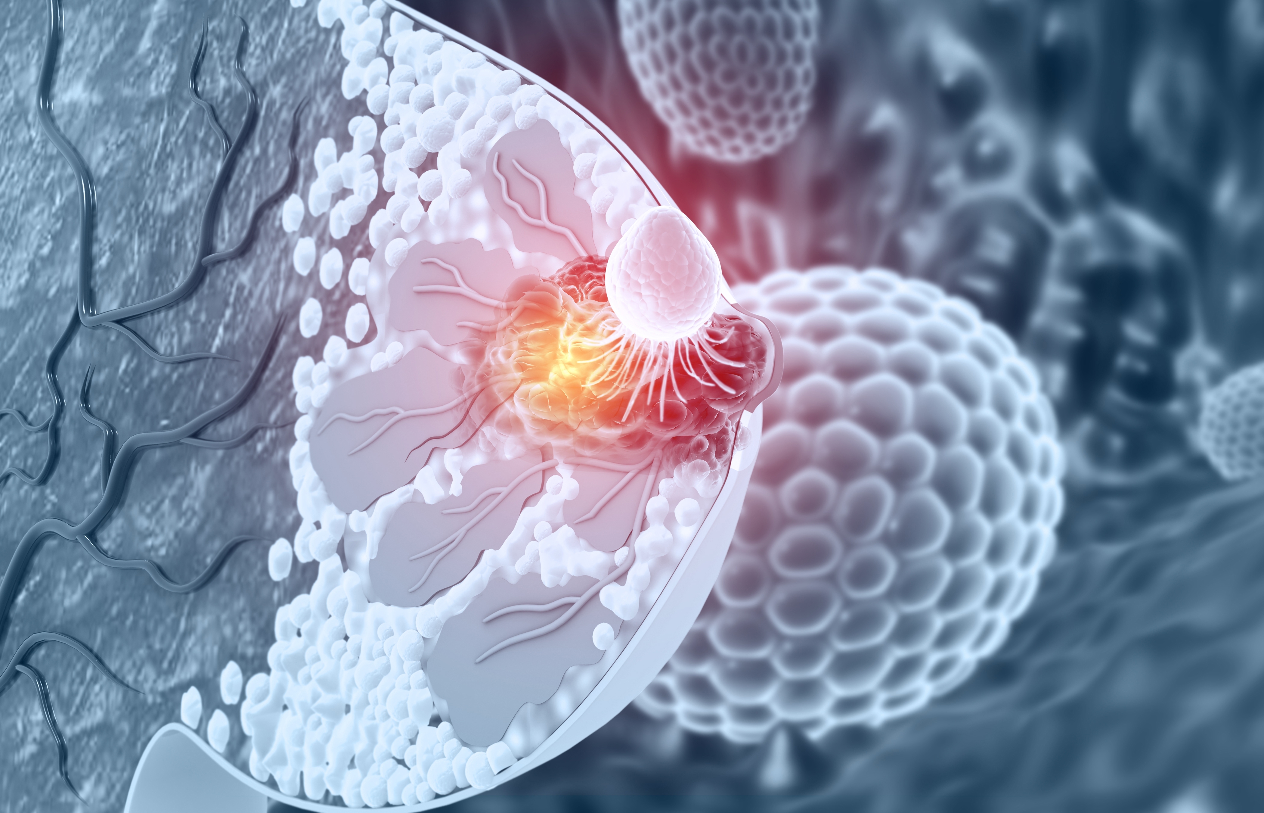 Update on the Evolving Management of Metastatic HER2- Expressing Breast Cancer