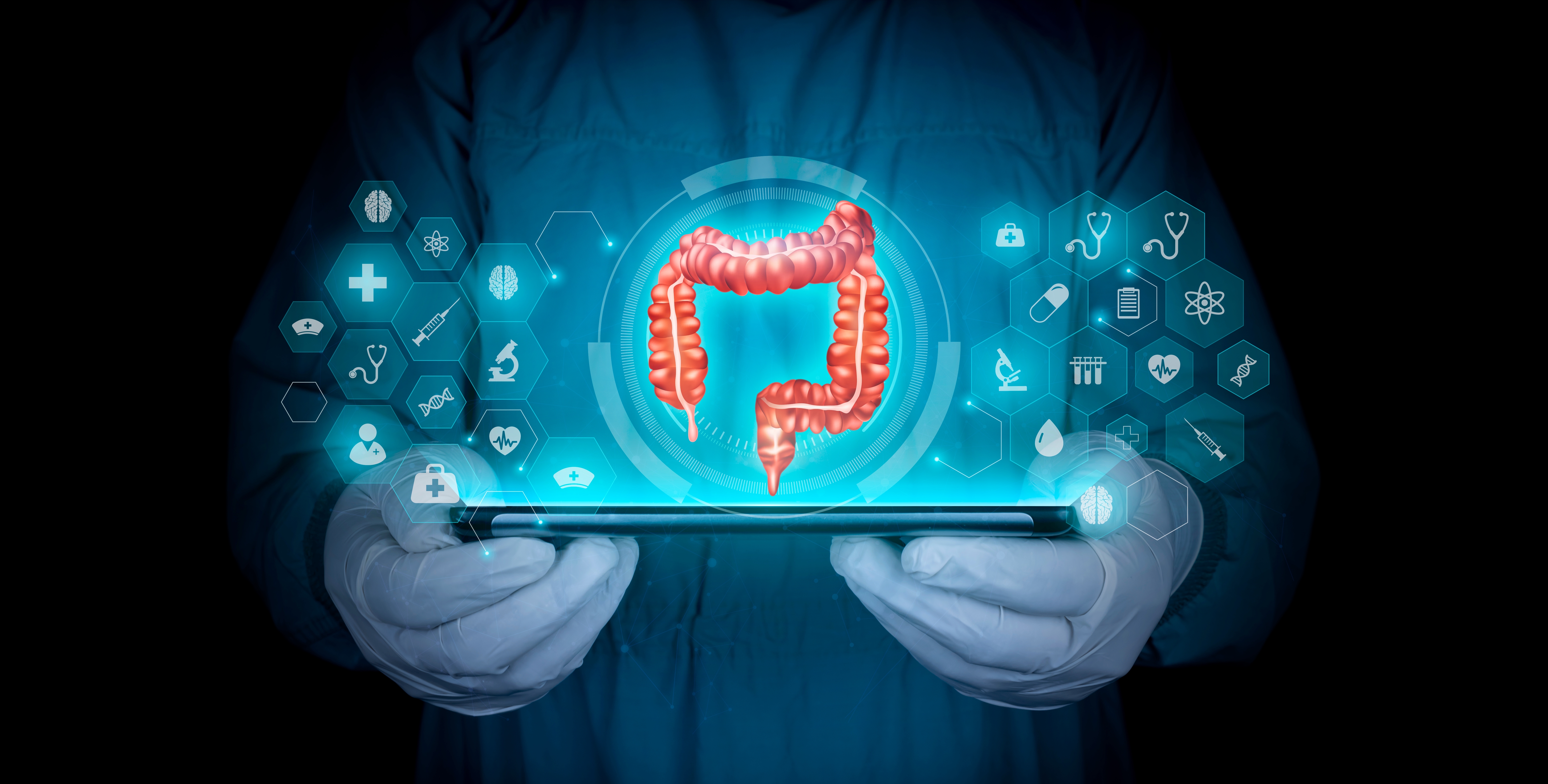 MRD Testing to Guide Adjuvant Chemotherapy for Resected Colon Cancer