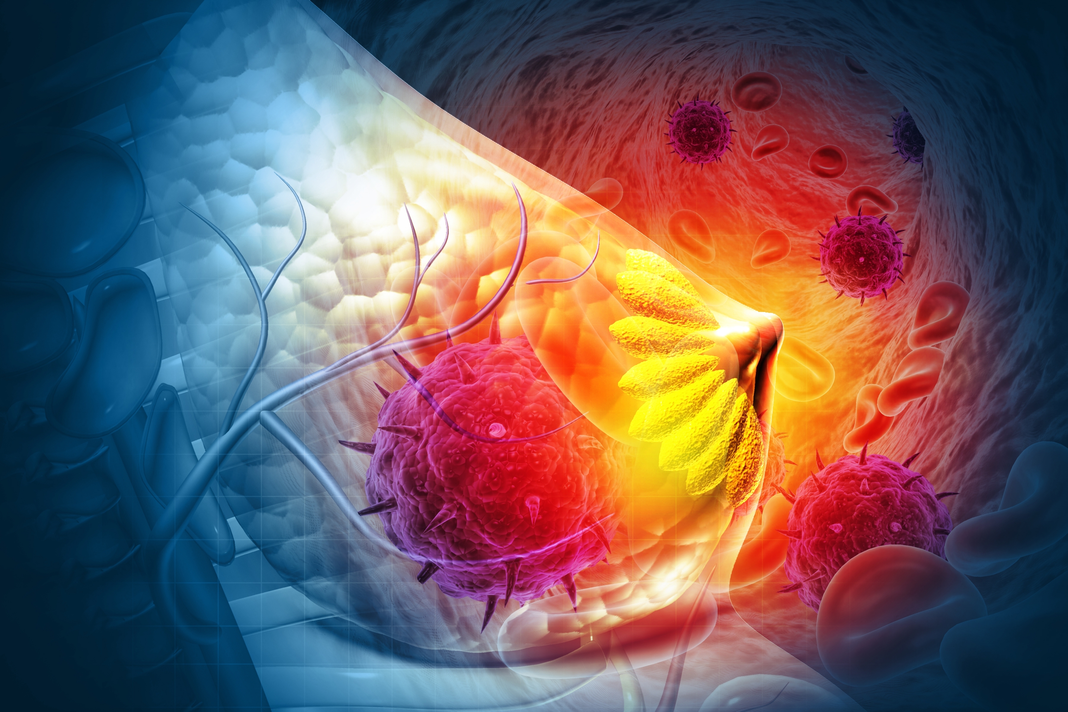 Management of HER2+ Breast Cancer Brain Metastases