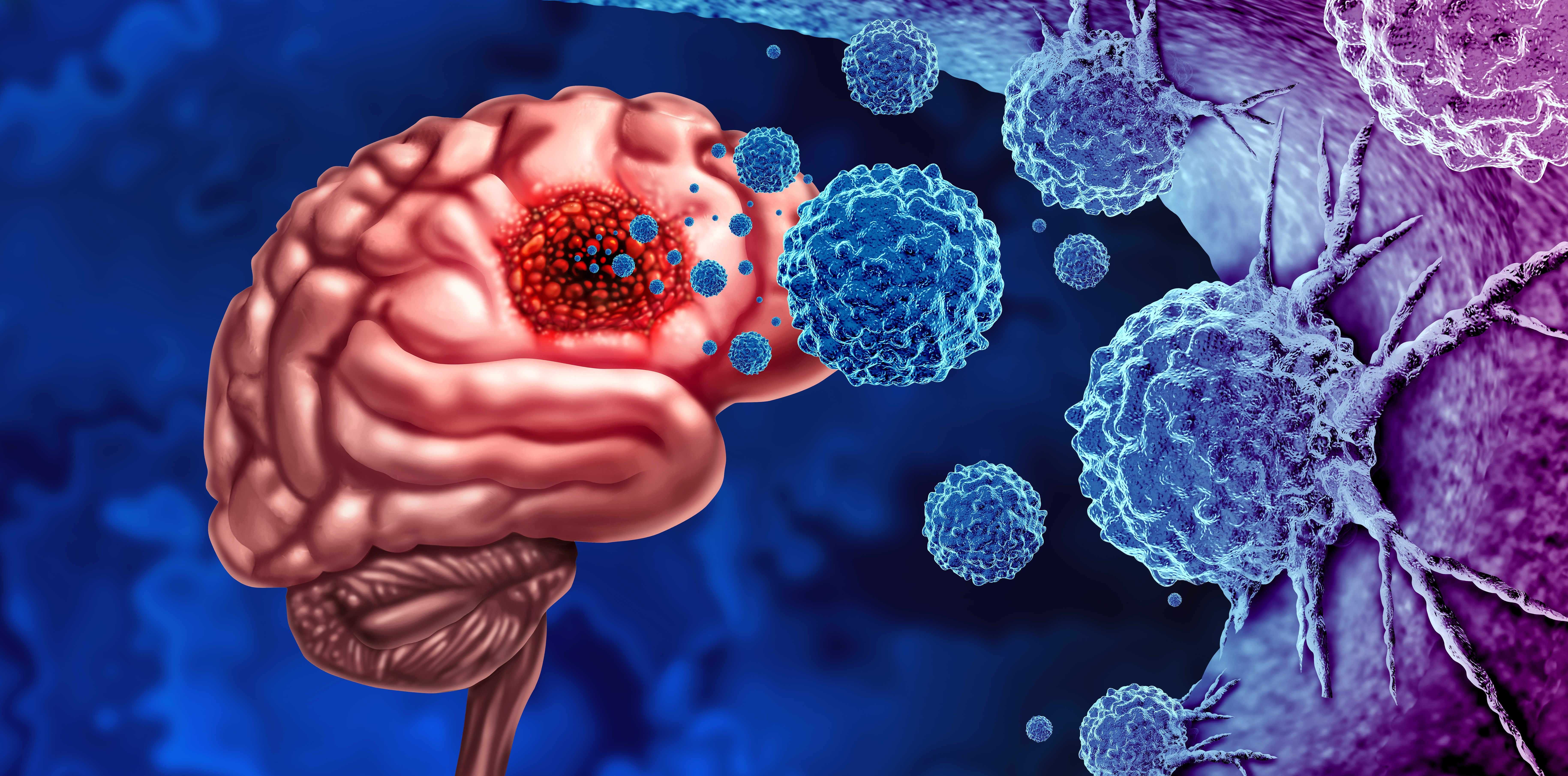 The role of molecular testing in the management of gliomas